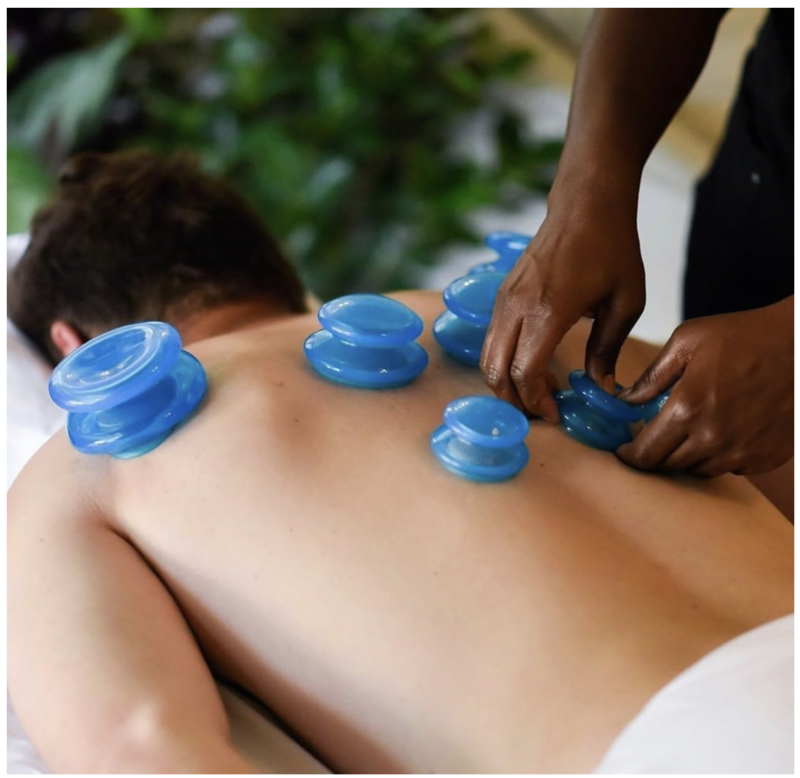 Cupping Kit for Massage Therapy - Image 2